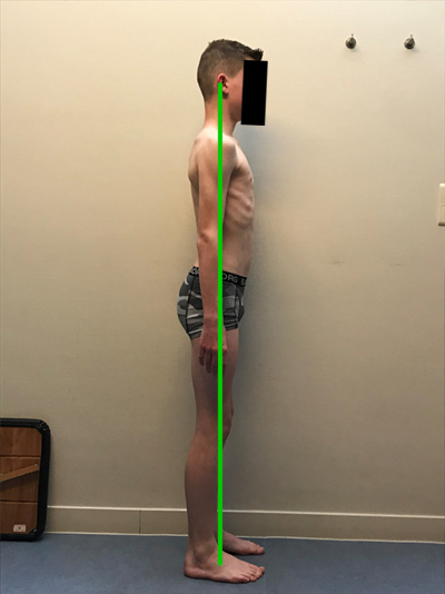 Structural Integration 3